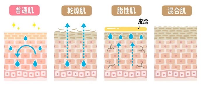 乾燥肌、脂性肌の症状